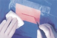 华卫医用手术膜