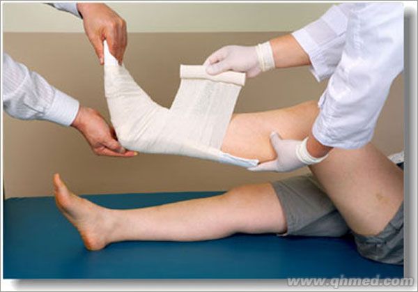 骨科高分子夹板 骨外科矫形 耗材