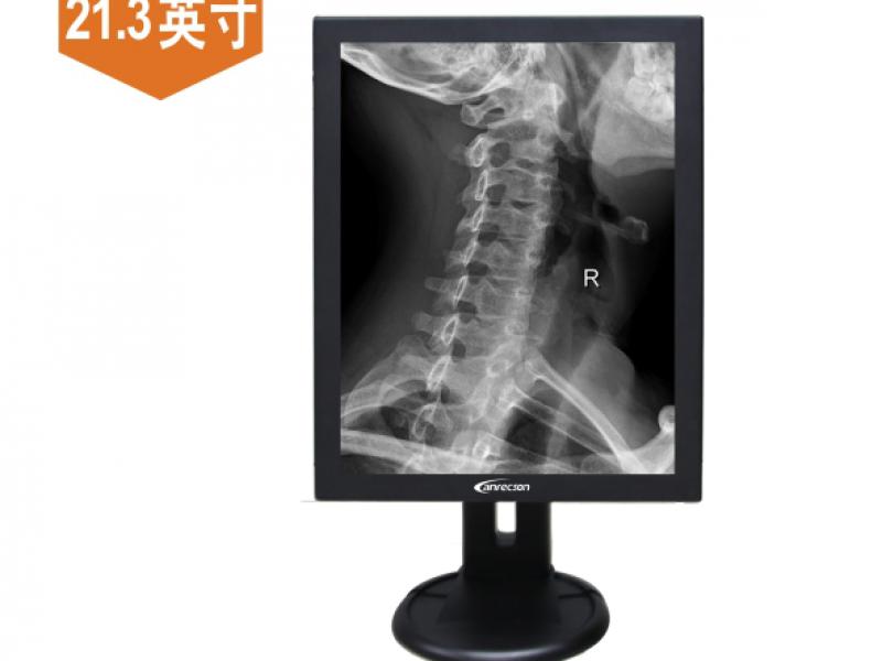 安立信医疗显示器