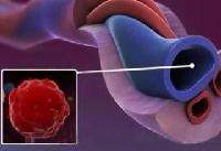 脐血源性干细胞