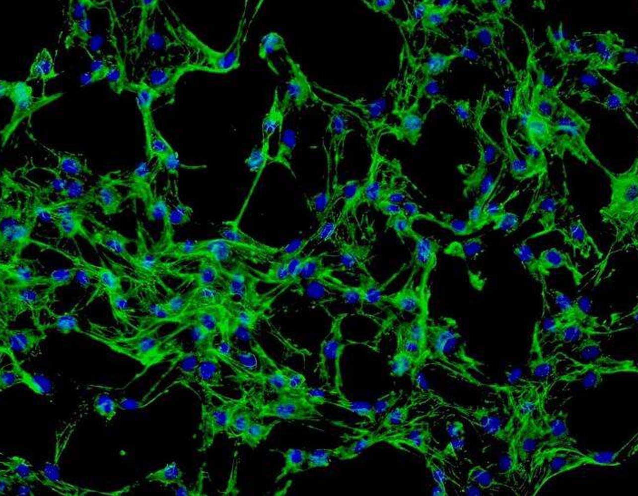 正常人皮肤成纤维细胞