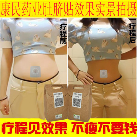 减肥贴 OEM定制|减肥贴厂家招商
